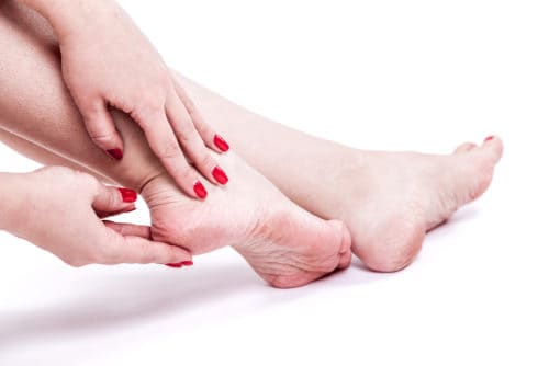 dry dehydrated skin on the heels of female feet with calluses